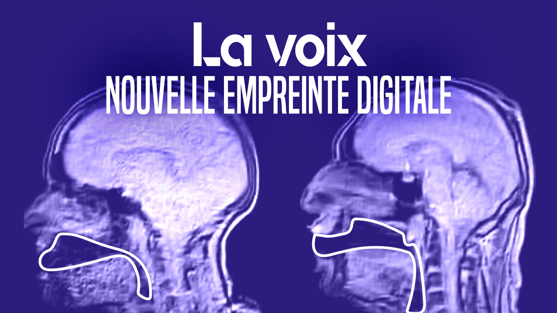 La voix : nouvelle empreinte digitale