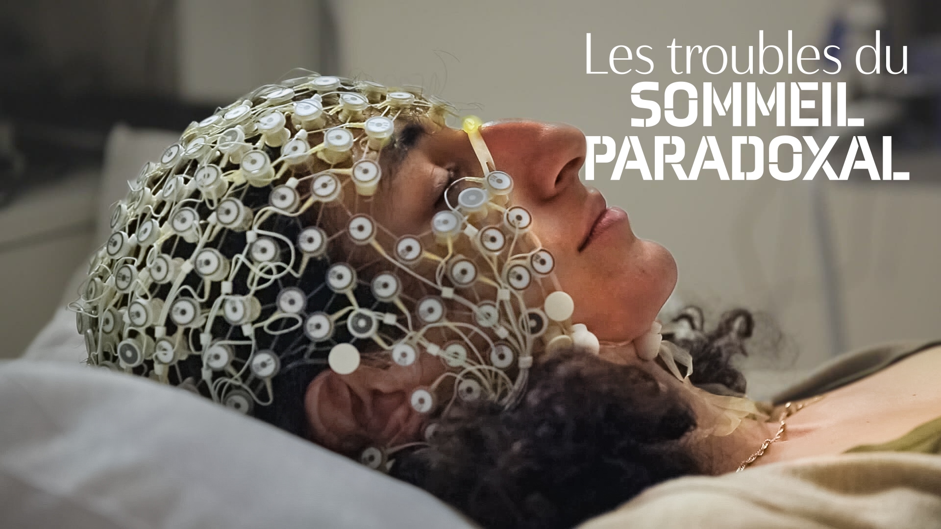 Les troubles du sommeil paradoxal