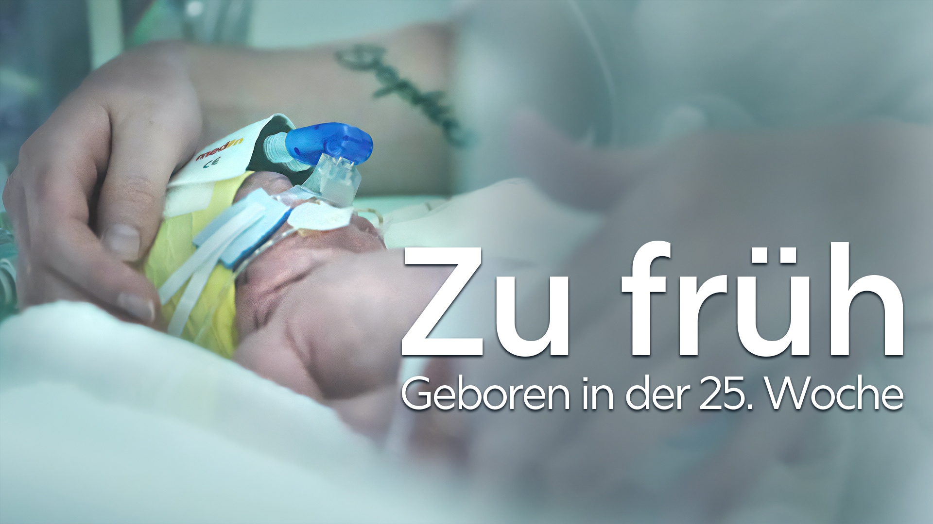 Zu früh – Geboren in der 25. Woche