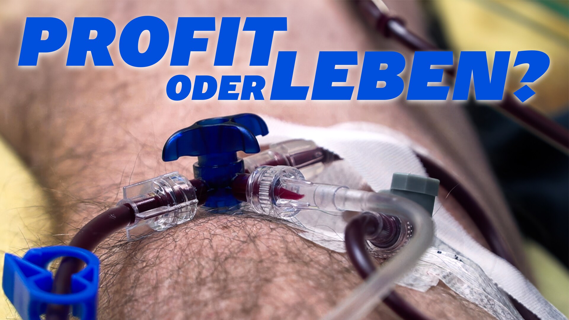 Profit oder Leben?