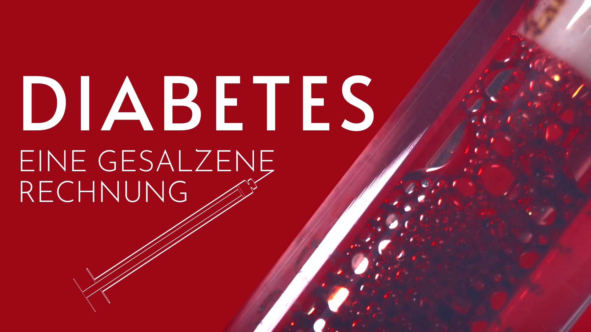 Diabetes - Eine gesalzene Rechnung