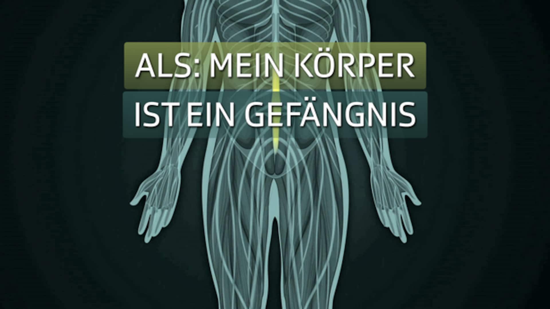 ALS: Mein Körper ist ein Gefängnis