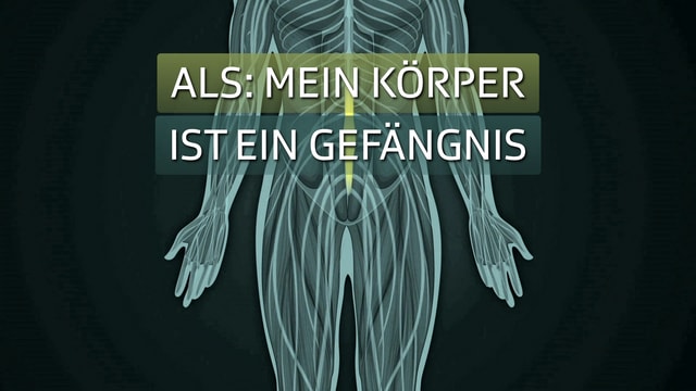 ALS: Mein Körper ist ein Gefängnis