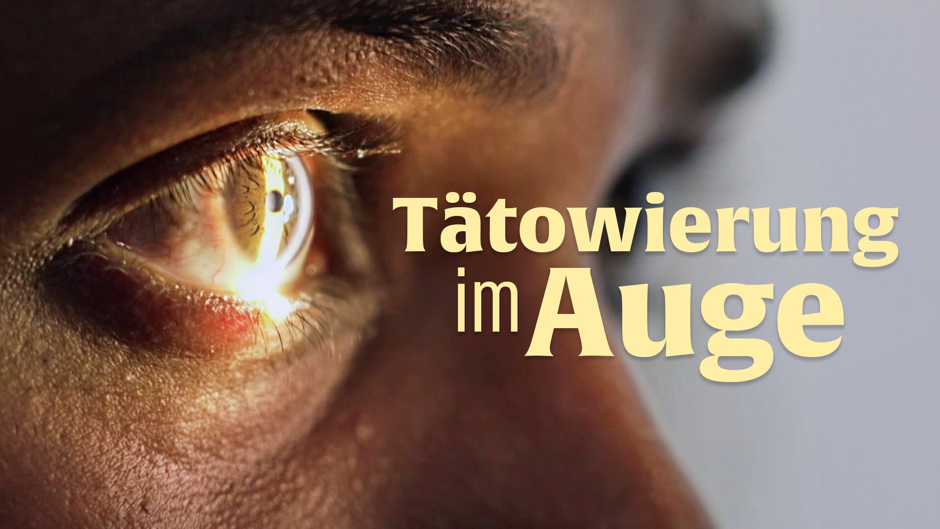 Tätowierung im Auge