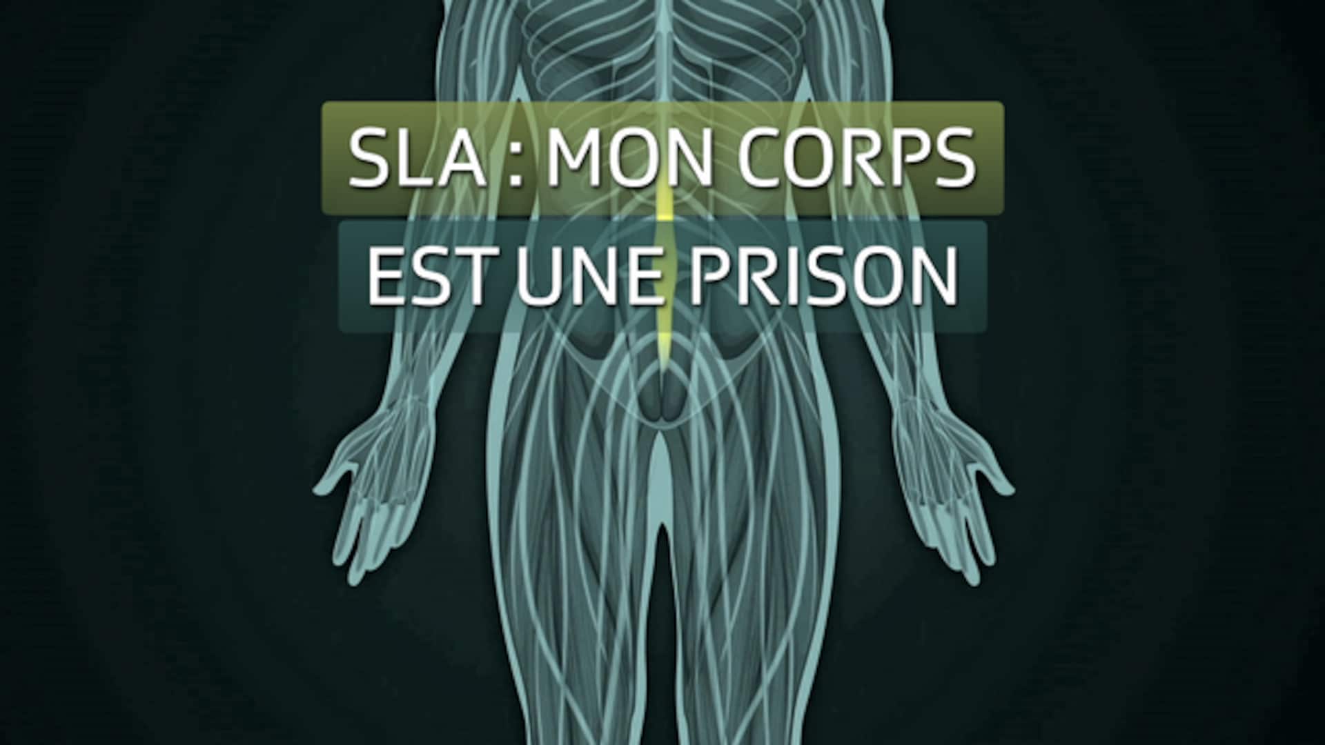 SLA : Mon corps est une prison