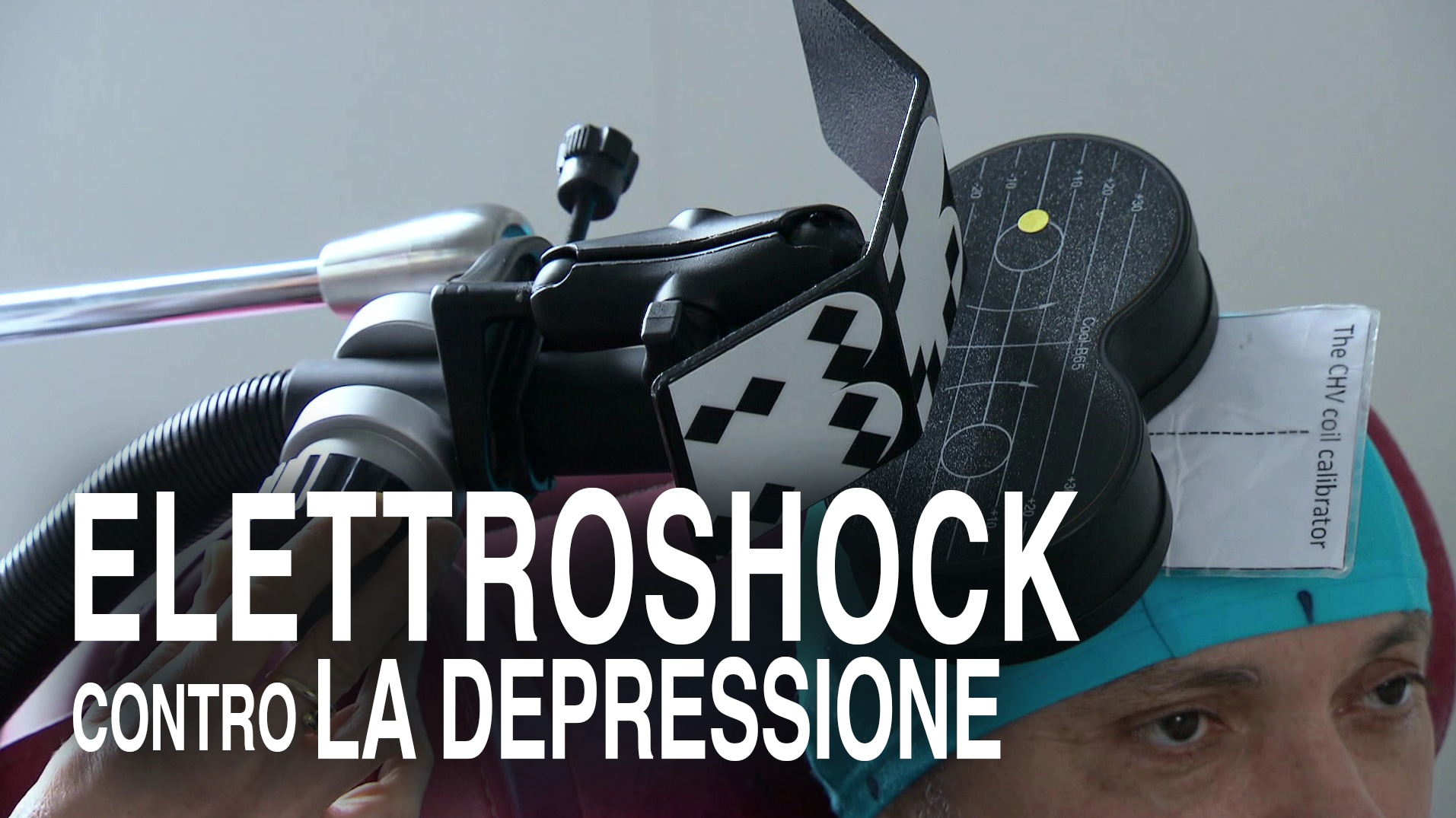 Elettroshock contro la depressione