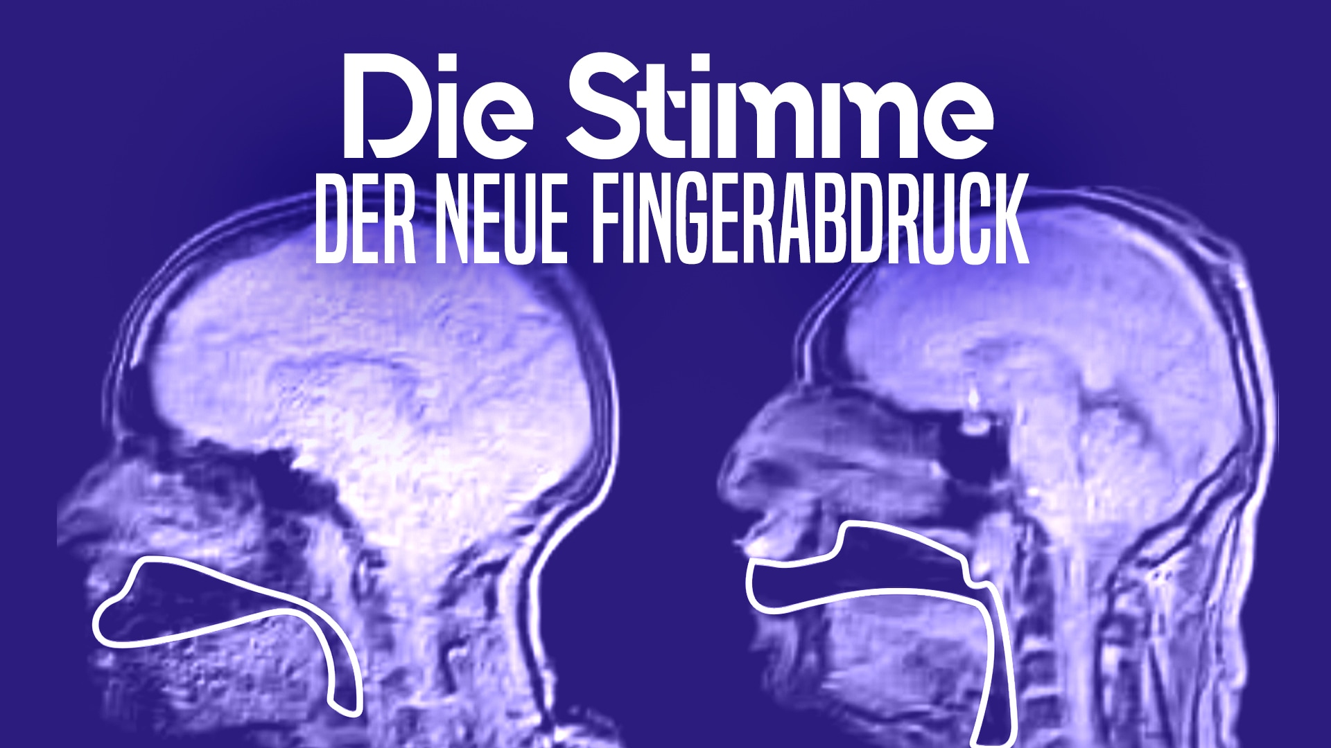 Die Stimme: Der neue Fingerabdruck