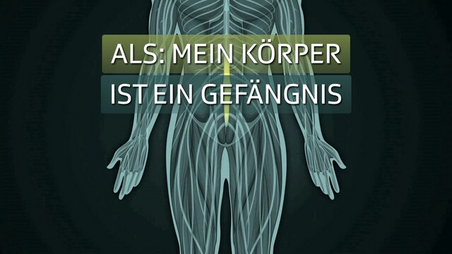 ALS: Mein Körper ist ein Gefängnis