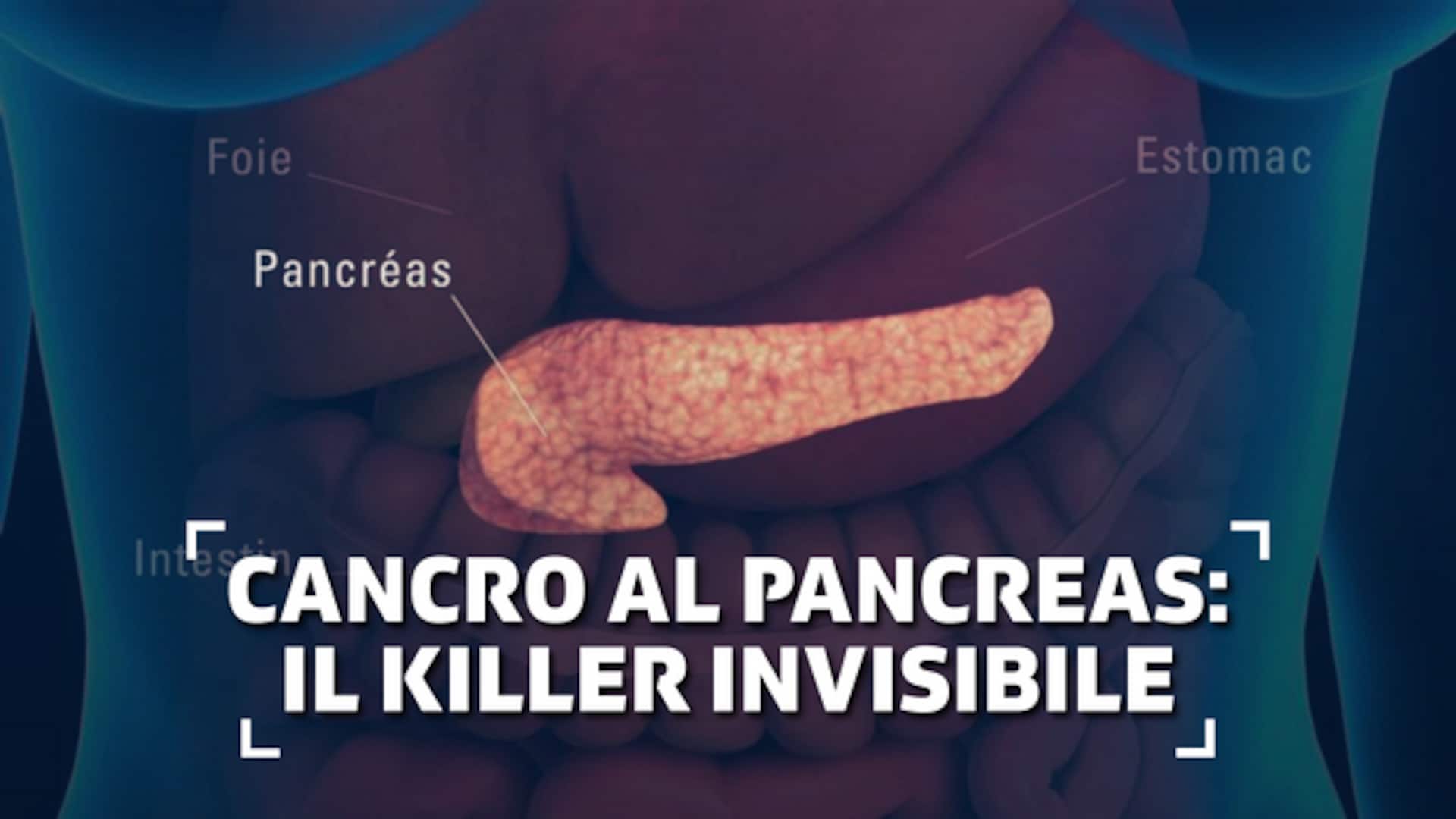 Cancro al pancreas: il killer invisibile