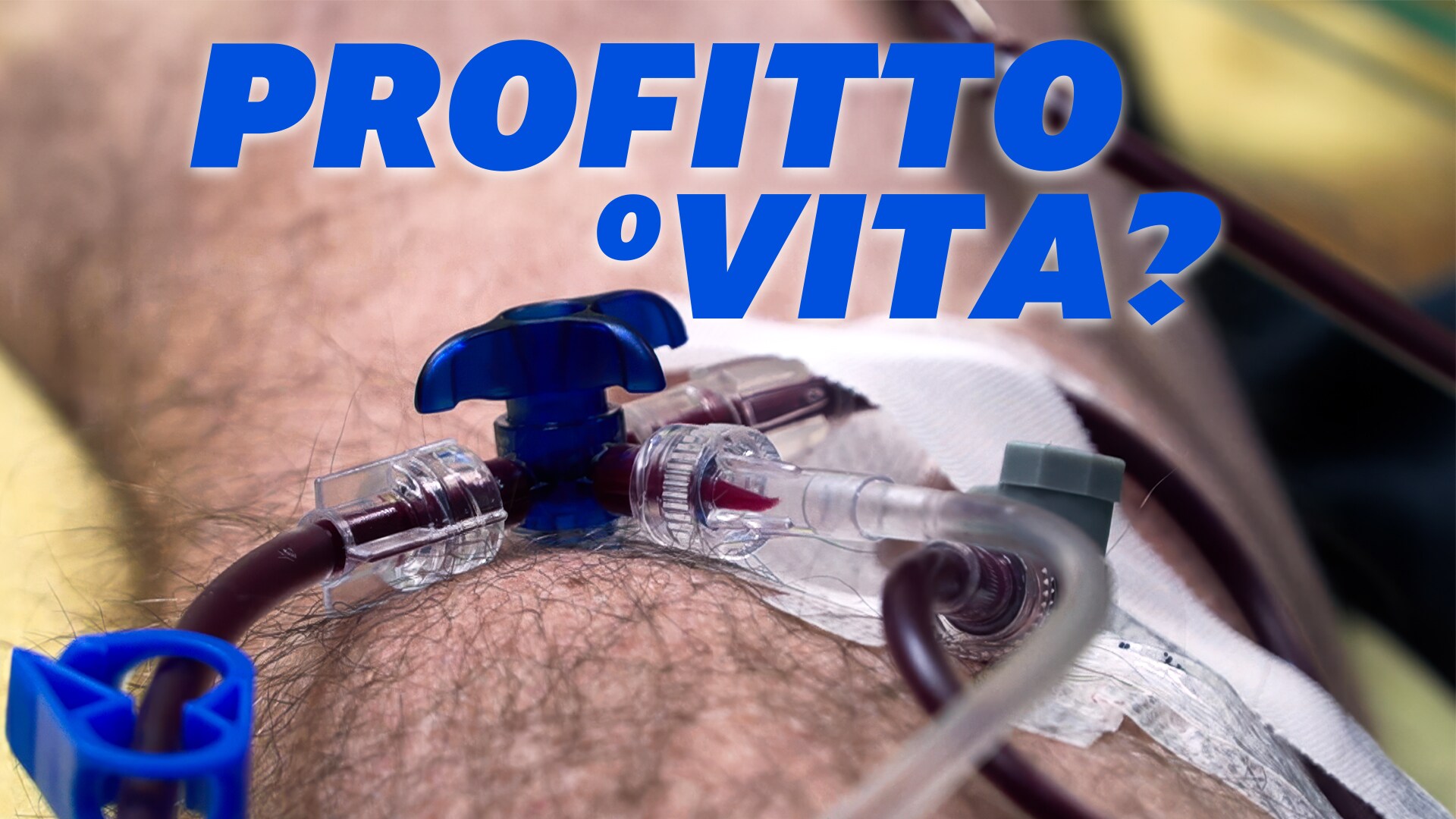 Profitto o vita? 