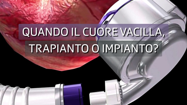 Quando il cuore vacilla, trapianto o impianto?