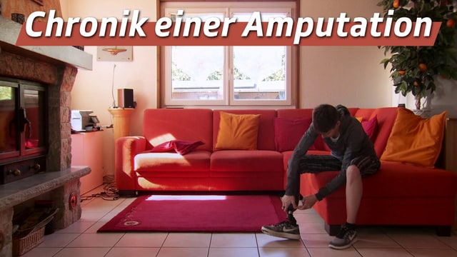 Chronik einer Amputation