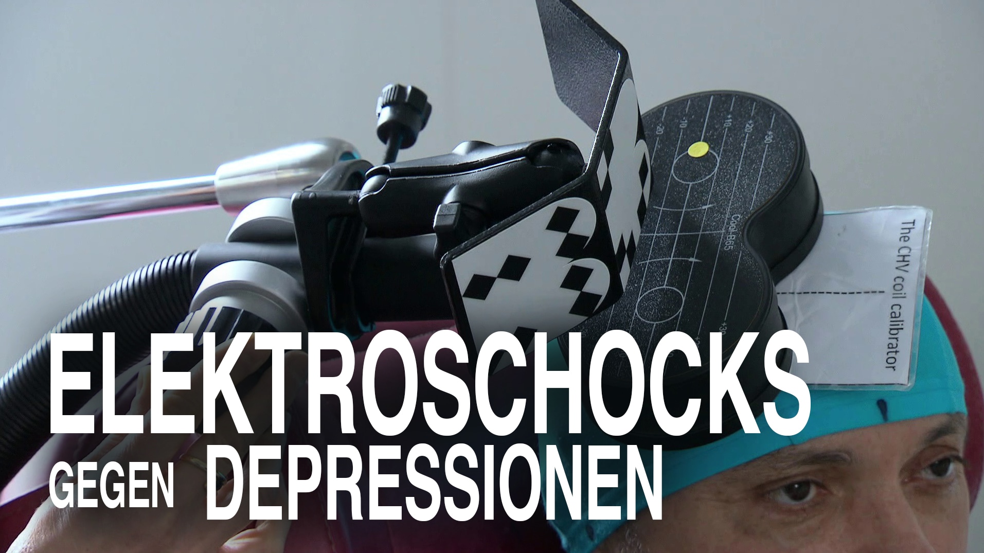 Elektroschocks gegen Depressionen