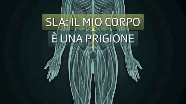 SLA: il mio corpo è una prigione