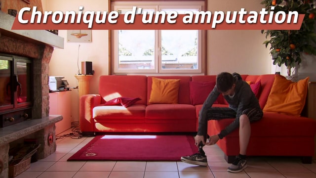 Chronique d'une amputation